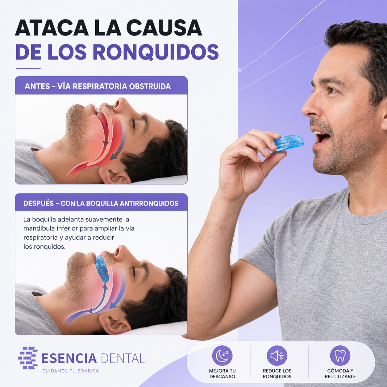 Boquilla Antirronquidos de Esencia Dental